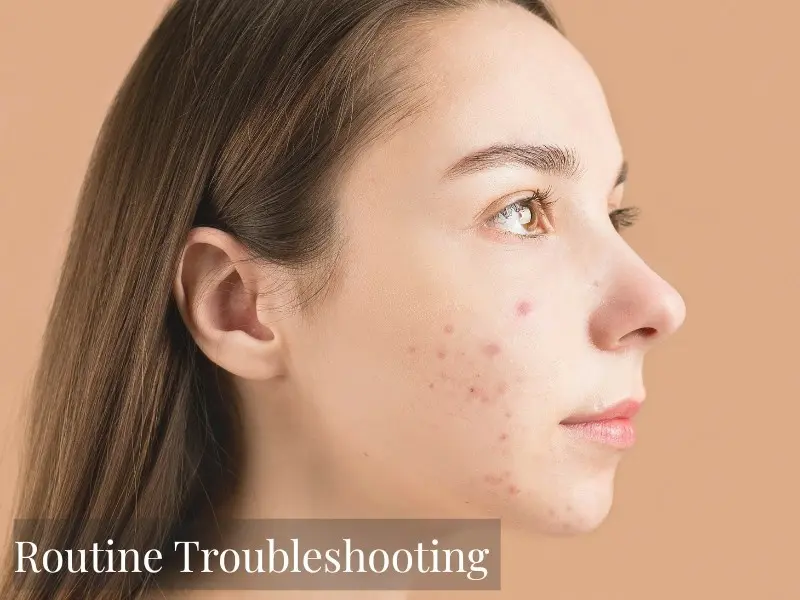 Woman with acne prone skin examining skin concerns for honest skincare guide for routine troubleshooting