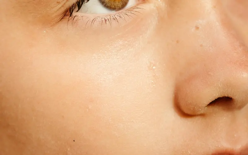 healthy calm skin after consistent skincare routine showing realistic long-term results
