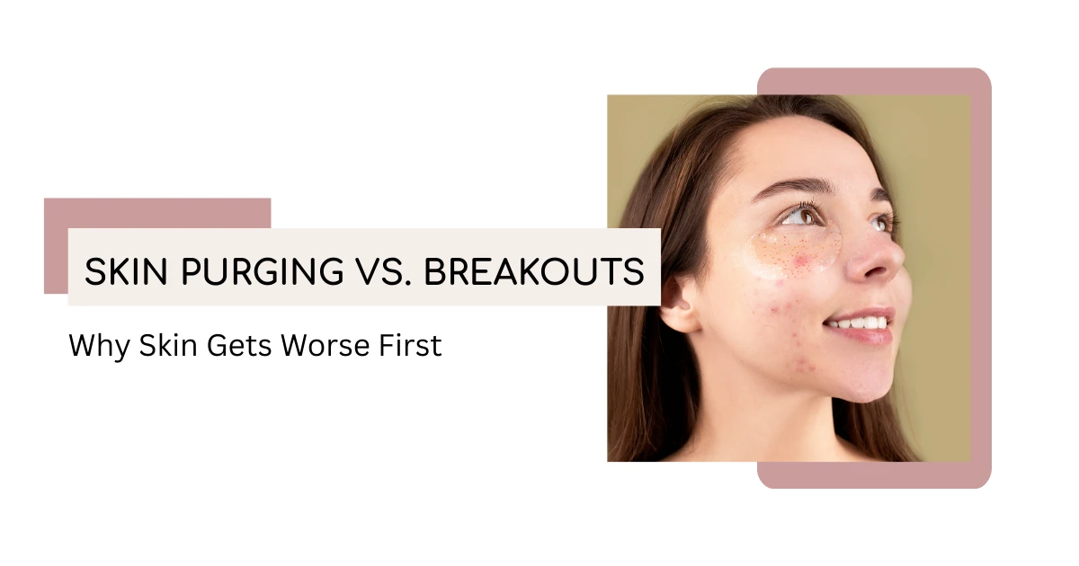 skin purging vs breakout — woman with skin congestion illustrating the difference